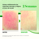 ANUA AZELAIC ACID 10 HYALURON REDNESS SOOTHING SERUM 30ml_GLB/EU V3
