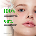 ANUA AZELAIC ACID 10 HYALURON REDNESS SOOTHING SERUM 30ml_GLB/EU V3