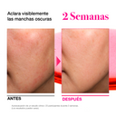 ANUA NIACINAMIDE 10 TXA 4 SERUM 30ml_GLB/EU V3