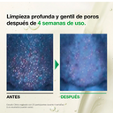 ANUA HEARTLEAF PORE CONTROL CLEANSING OIL 200ml_GLB/EU V3