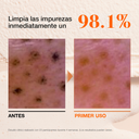 ANUA RICE ENZYME BRIGHTENING CLEANSING POWDER 40g_GLB/EU V3