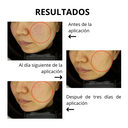 Suero aclarante anti-melasma + bloqueador solar Gimiya Whitening