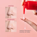 Calamine Pore Control Cleansing Oil | Aceite Limpiador